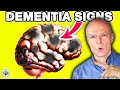 10 silent warning signs youre going to get dementia