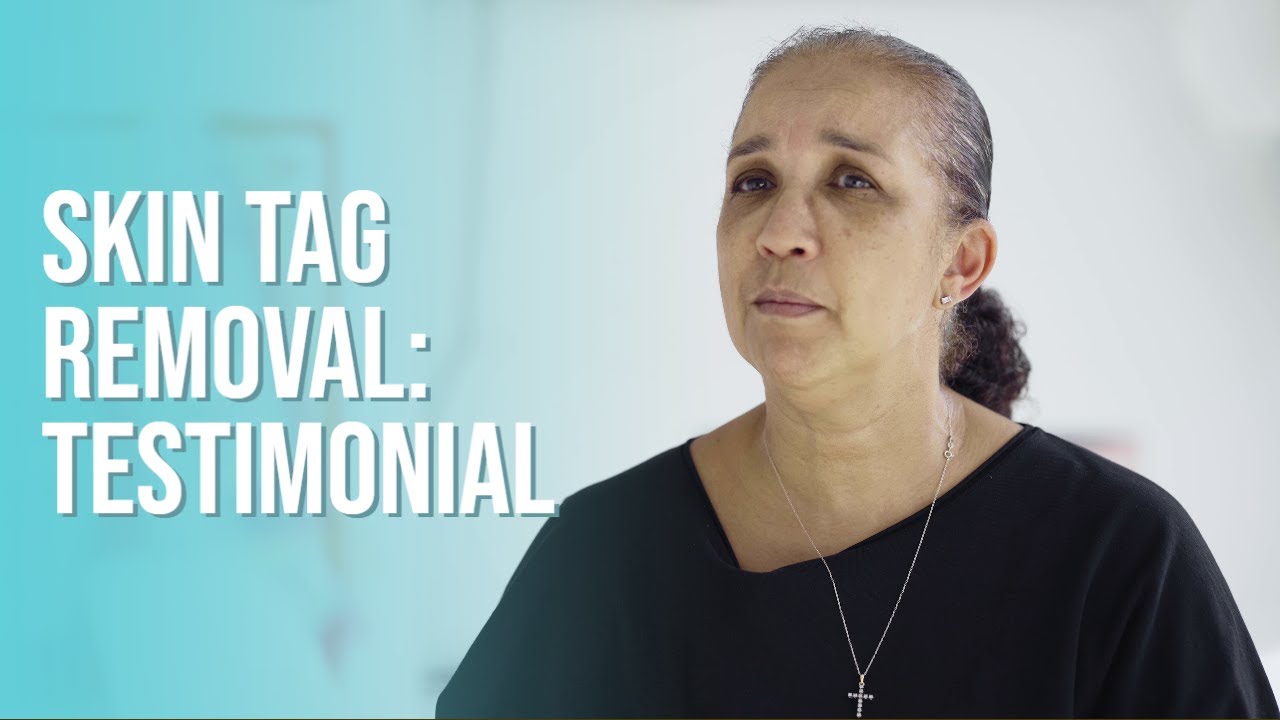Best Skin Tag Removal in Shumaila's 