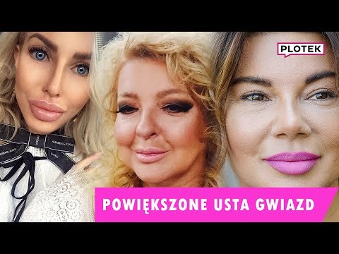 Wideo: Olga Buzova, Anna Khilkevich I 7 Innych Gwiazd, Które Powiększyły Usta
