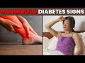 Top 7 Dangerous Diabetes Nighttime Signs You Should Know
