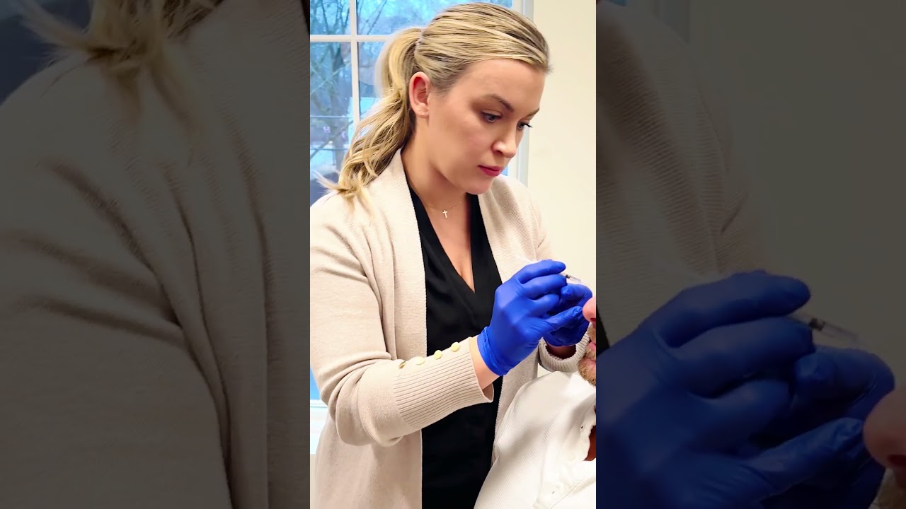 Filler Injections | Dr. Vincent Zubowicz | Thrive Medical Spa in Milton, GA