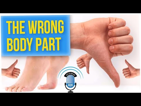 Girl Has Thumb Replaced With Her Toe After Hospital Mistake 