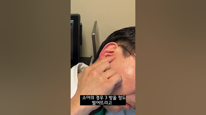 (숏) 이용액 넣는 방법
