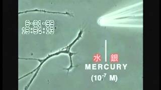 キレ-ション治療プロトコ-ル: 血管性疾患、変性疾患、重金属障害に対するEDTA等のキレ-ト剤の安全で効果的な投 キレーション治療を知る | 日本キレーション協会