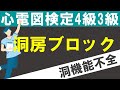 洞房ブロック【チャレンジ心電図検定4級3級】