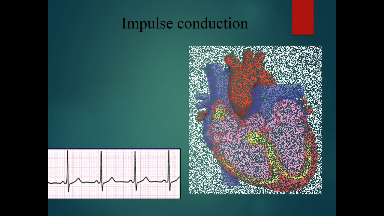 Cardiac Arrhythmia Pathophysiology And Pharmacotherapy Part 1 YouTube