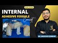 Internal adhesive ferrule concept || Dr. Mostafa Zordok 