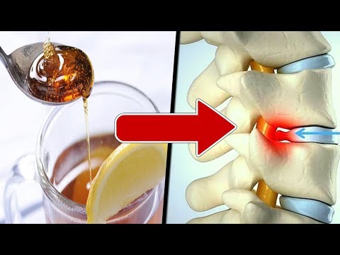 Como MEJORAR Una HERNIA Discal Con Tratamiento Naturales