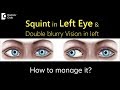 Management of Squint in Left Eye &amp; Double blurry Vision in left?- Dr. Sunita Rana Agarwal