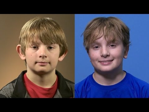12-Year-Old Bullied Boy Gets Plastic Surgery To Pin Back His Ears That Stuck Out