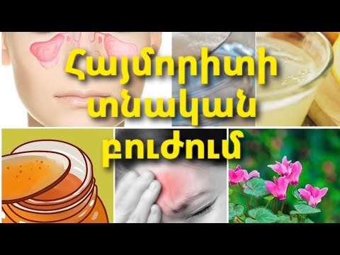 Video: Հիպերտրիխոզ - ինչ է դա: Հիպերտրիխոզի պատճառները, ախտանիշները, բուժումը