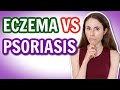 ECZEMA VS PSORIASIS: HOW TO TELL THE DIFFERENCE 🤔 @DrDrayzday