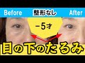 1週間で激変！目の下のたるみ整形級で取る！マッサージ＆エクササイズ　ためしてガッテン