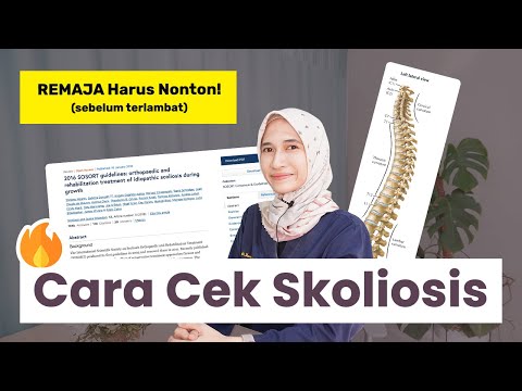 Remaja Harus Nonton: Cara Gampang Cek Kelainan Tulang Belakang (Skoliosis) | dr. Vania Utami