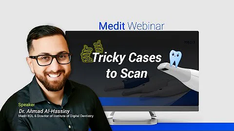 [Full ver.] Tricky Cases to Scan