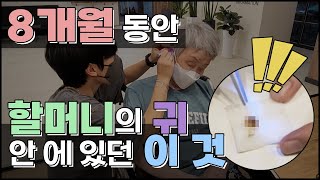 치매 할머니의 귀가 잘 안들렸던 이유