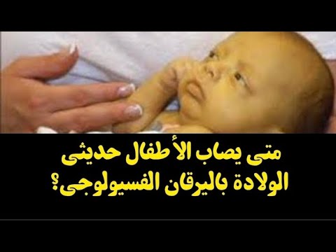 متى يصاب الأطفال حديثي الولادة باليرقان الفسيولوجي