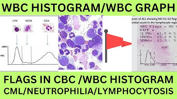 WBC HISTOGRAM. FOR STUDENTS.WL,WU,T1,T2,F1,F2 F3,AG FLAGS IN WBC HISTOGRAM. WBC GRAPH IN CBC PRINT