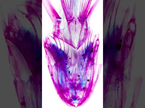 【透明標本】クロカサゴ