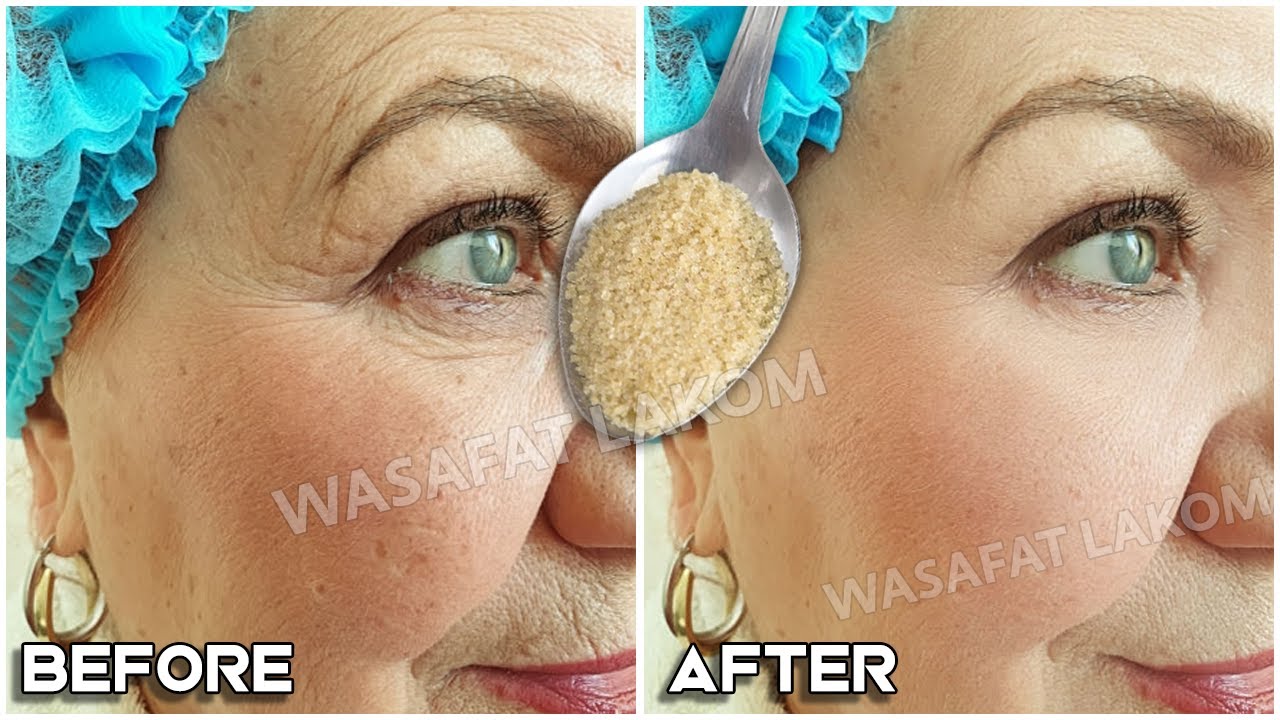 A mask to remove wrinkles, and remove dead cells,👌 a mask that will