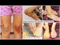 Summer Most Effective Dark Knees and Elbows Whitening  Home Remedy | Rinkal Soni