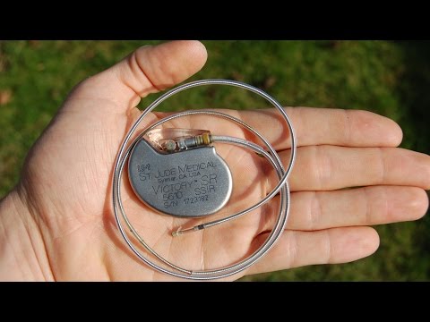 Is the Pacemaker the answer to all heart problems? - Professor Martin Elliott Instructional Video