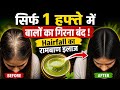 SUMMER SPECIAL सिर्फ 1 हफ्ते में बालों का गिरना बंद ! Hairfall का रामबाण इलाज | how to stop hairfall