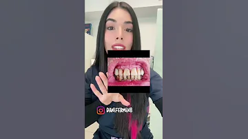 ¿Qué puede saber un dentista de tu boca?