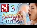 3 Alergias Curiosas