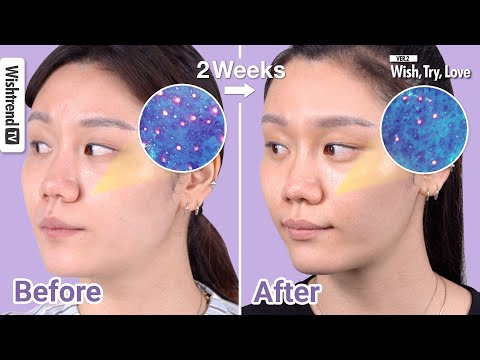 6 Tips on How To Take <strong>Care</strong> of Clogged Pores, Large Pores, Open Pores on <strong>Face</strong> | Wish, Try, Love