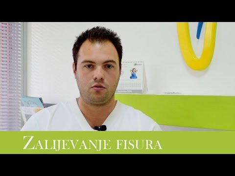 Zalijevanje fisura