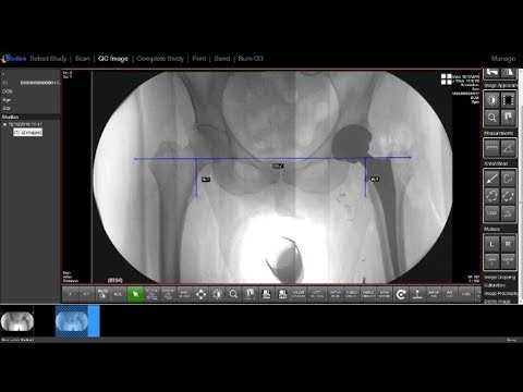 Panoramic Fluoro Image Stitching Software