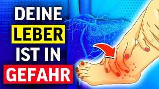 6 Alarmierende Anzeichen Dafr Dass Deine Leber In Gefahr Ist
