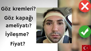 Gercekler Goz Kremleri Goz Kapagi Ameliyati Oncesi Sonrasi Goz Cevresi Bakimi Youtube Gercekler Goz Kremleri Goz Kapagi Ameliyati Oncesi Sonrasi Goz Cevresi Bakimi Youtube