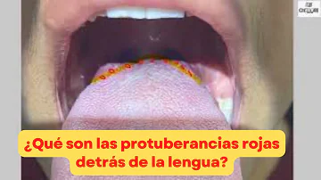 ¿Hay personas que nacen sin papilas gustativas?