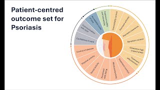 A patient-centred outcome set for psoriasis: an introduction to the project
