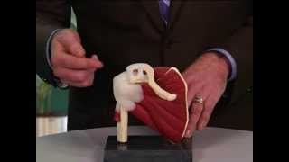 Shoulder Tendonitis