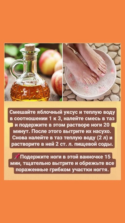 Раствор из яблочного уксуса для ног #яблочныйуксус #раствор #польза # ...