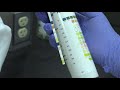 Urinalysis