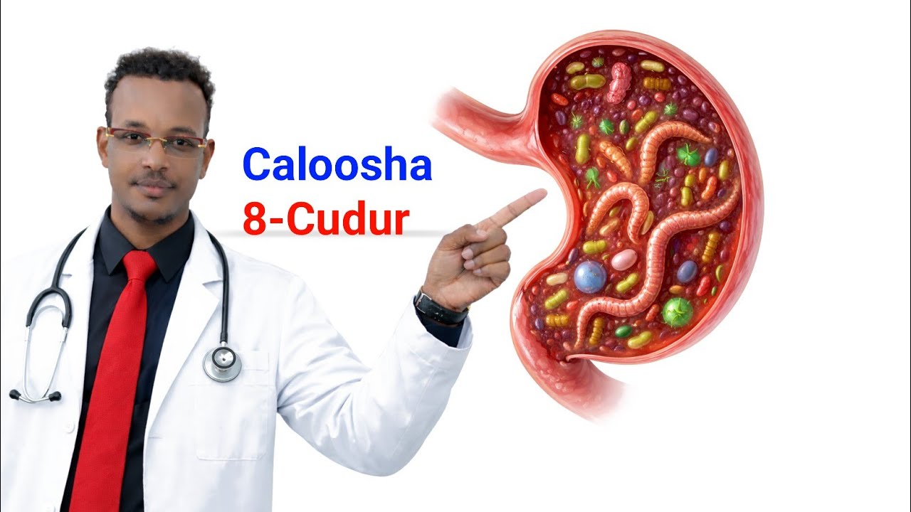 8-Cudur ee keenta xanuunka Caloosha , boga kala Baro calaamadaha Lagu kala Saaro