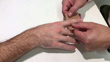 Splinting the DIP Joint by ATS