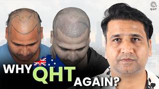 Hair Transplant In Bhopal (Hx - Uaqp) Best Results & Cost Of Hair Transplant In Bhopal.