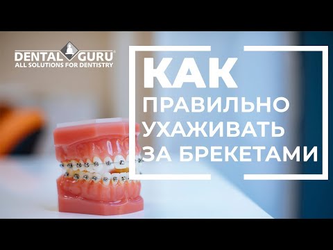 Video: Kaip Pasirinkti Tinkamą Dantų šepetėlį Vienerių Metų Vaikui