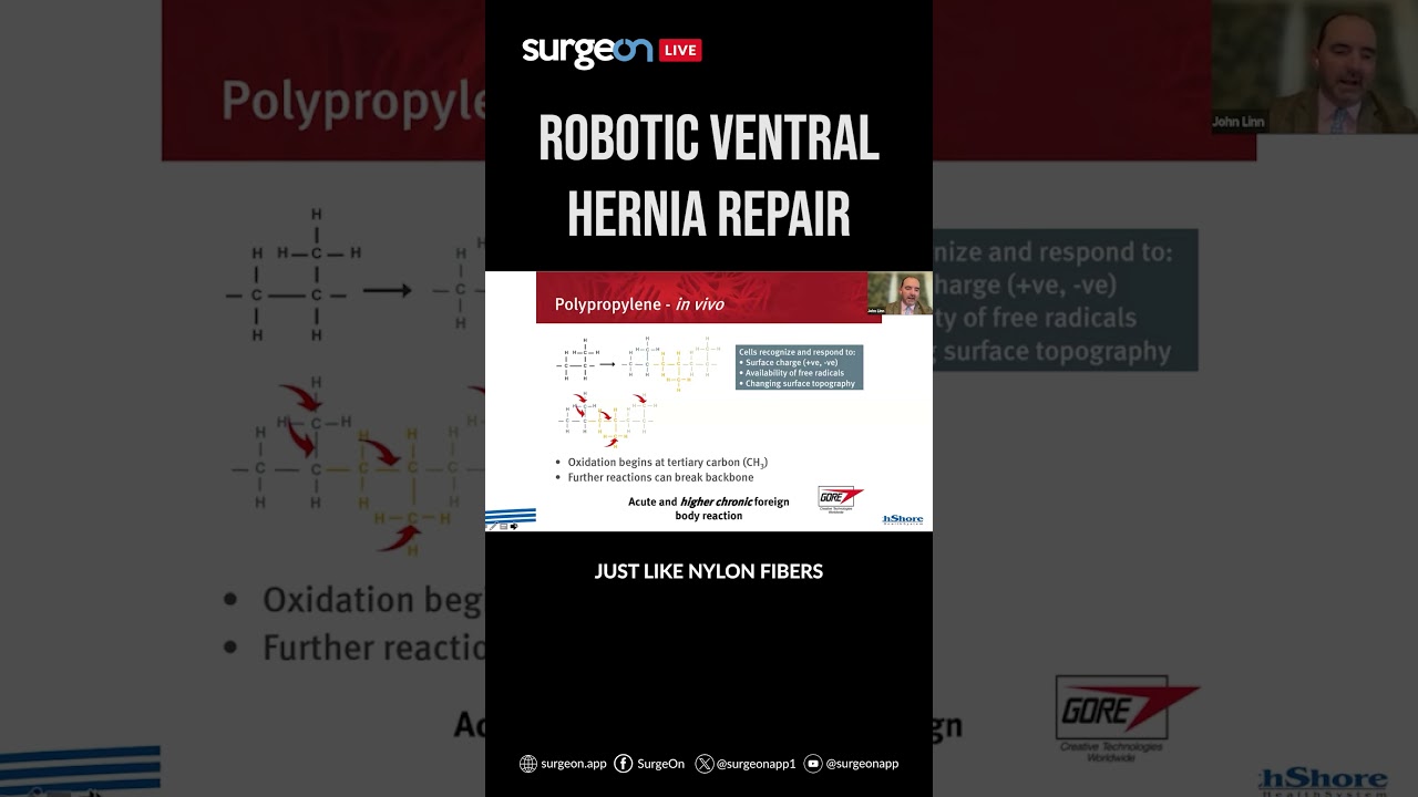 Navigating Complex Robotic Ventral Hernia Repai