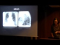 Curso de Radiología Torácica y Musculoesquelética 20 oct 2014 5 de 5