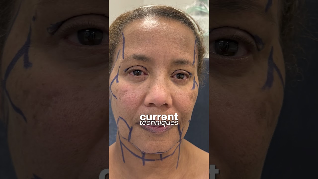 Свежий, но не перегруженный образ | Современные технологии и выбор правильного врача 