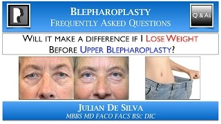 Will LOSING WEIGHT make a difference before Upper Blepharoplasty?