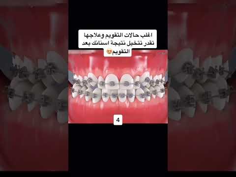 فيديو: مجفف الأرضية هو مساعد رائع