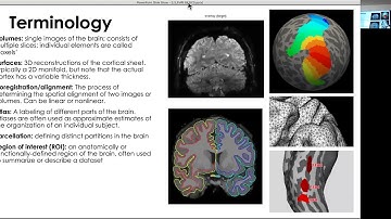 L3 FMRI BASICS