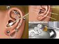Asmr piercing cleaning animation blackhead removing pus from piercing ear infection treatment